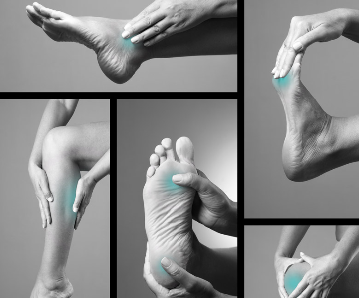 Can Morton's Neuroma Cause Toe Pain? Symptoms and Solutions