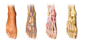 What Does Morton's Neuroma Pain Feel Like? Patient Experiences
