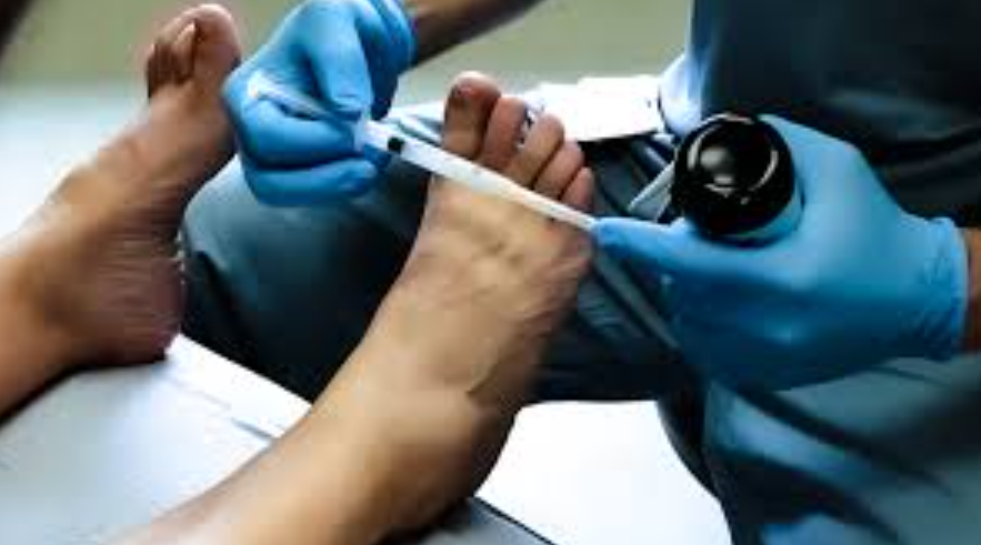 Best Injections for Morton's Neuroma: Cortisone and Beyond