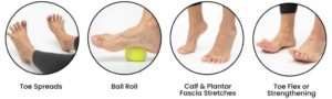 Best Foot Exercises for Morton's Neuroma: Pain Relief Tips