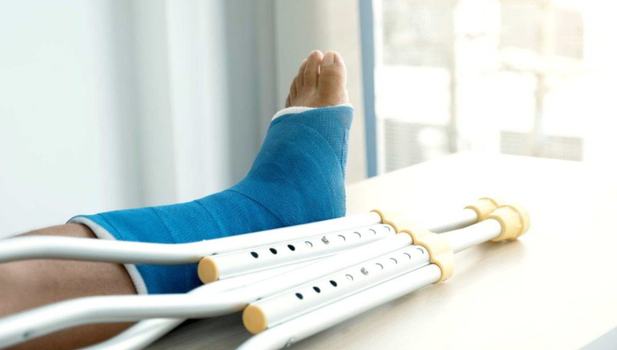 How Soon Can You Walk After Morton's Neuroma Surgery